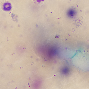 Case245_B.jpg Figure B