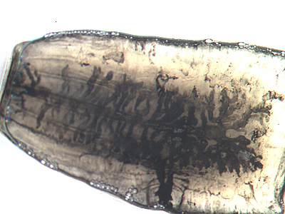 A microbiologist at a public health laboratory contacted DPDx for diagnostic assistance for identifying a tapeworm proglottid received at their lab. A wet mount was prepared from some of the transport media, and eggs morphologically-consistent with those of Taenia were observed. 