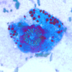 Case247_B.jpg Figure B