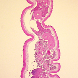 Case248_B.jpg Figure B