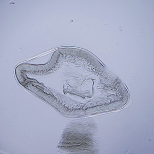 A small worm approximately 2.5 cm in length was recovered from the stomach of a 38-year-old male. The anterior end had been damaged by the extraction but it was sent to the CDC to see if it could still be identified. 