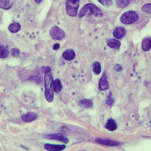 Case250_B.jpg Figure B