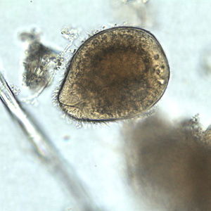 A 45-year-old pig farmer from rural Georgia presented to his health care provider with abdominal pain, cramps and diarrhea. Stool specimens were collected in polyvinyl alcohol (PVA) and 10% formalin for ova and parasite (O&P) examination. 