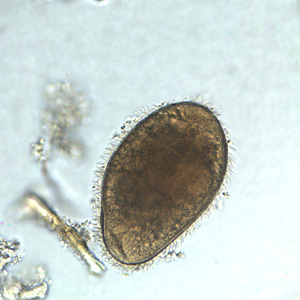 Case251_B.jpg Figure B