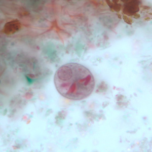 Case251_C.jpg Figure C