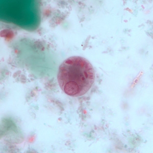 Case251_D.jpg Figure D