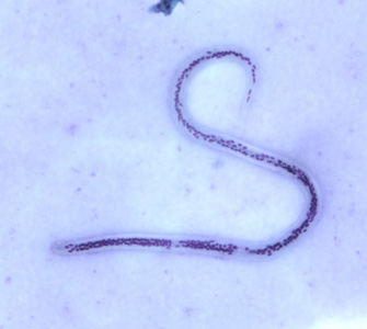 A 29-year-old man from Haiti had blood drawn for routine work-up, following hospitalization for complications with a congenital disorder. The blood was collected in EDTA tubes and sent to Hematology and Microbiology for evaluation. 