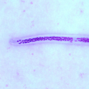 Figure B