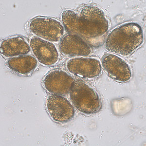 June - 2009 - Case #253 A 30-month-old child born in China was recently adopted by a family in the Netherlands. Three consecutive stool specimens were obtained for ova and parasite (O&P) testing, as part of the standard procedure during child adoption. There were no complaints.