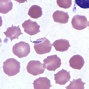 Case254_B.jpg Figure B