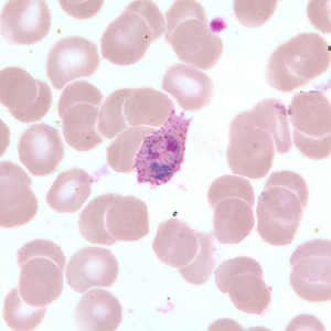 Case255_B.jpg Figure B