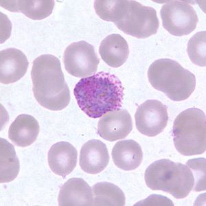 Case255_D.jpg Figure D