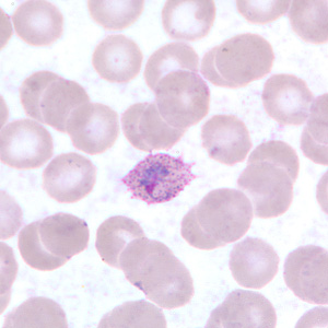 Case255_E.jpg Figure E