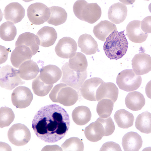 Case255_F.jpg Figure F