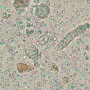 Case256_B.jpg Figure B