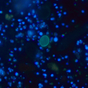 Case256_D.jpg Figure D