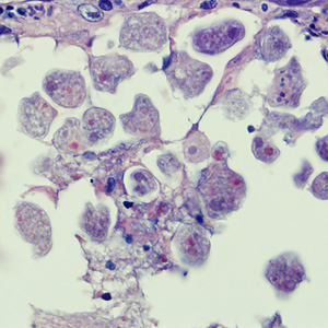 Case258_B.jpg Figure B