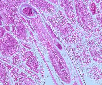 A four-year-old child was admitted to the hospital for sever abdominal pain mimicking appendicitis. A small section of bowel was removed and sent to the Pathology Department for work-up.