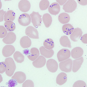 Case262_B.jpg Figure B