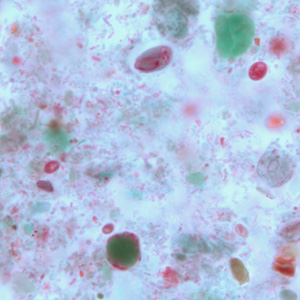 Case264_B.jpg Figure B