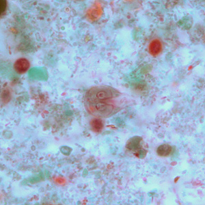 Case264_C.jpg Figure C