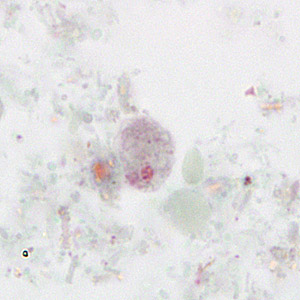 A 29-year-old man went to a local clinic with complaints of intermittent abdominal cramping and mild diarrhea. He explained that he had been diagnosed with roundworms (Ascaris lumbricoides) three months prior and was concerned that he may not have completely cleared the infection.