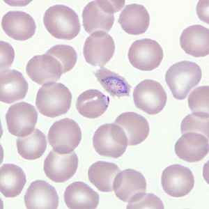 Case266_B.jpg Figure B