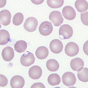 Case266_D.jpg Figure D