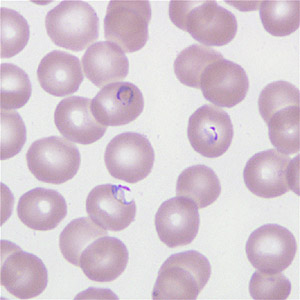 Case266_E.jpg Figure E