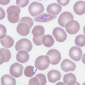 Case266_F.jpg Figure F