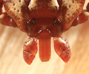 Case268_B.jpg Figure B