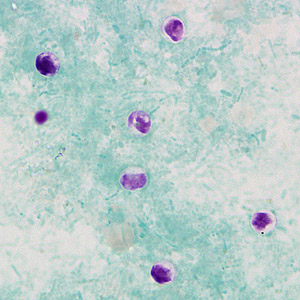 Case269_B.jpg Figure B