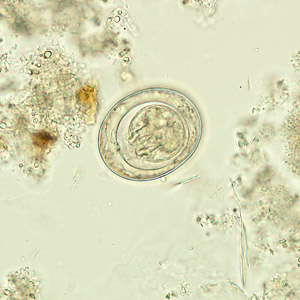 A six-year-old boy was taken to a local clinic for abdominal discomfort. A stool specimen was collected in formalin for routine ova-and-parasite (O&P) examination. 