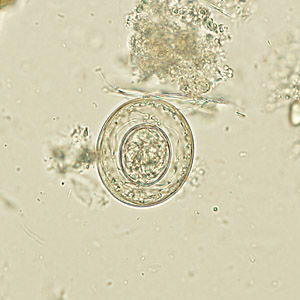 Case270_B.jpg Figure B