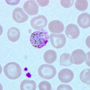 Case271_B.jpg Figure B