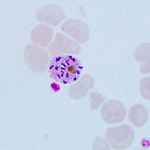 Case271_D.jpg Figure D