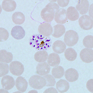 Case271_E.jpg Figure E