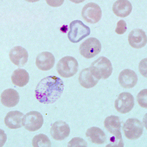 Case271_F.jpg Figure F