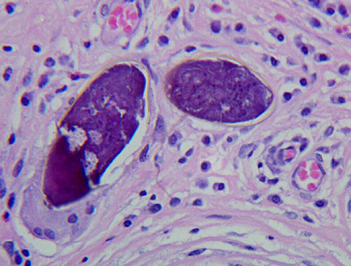 Case272_B.jpg Figure B