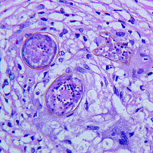 Case272_C.jpg Figure C