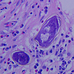 Case272_D.jpg Figure D