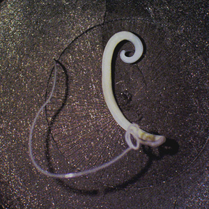 Case273_B.jpg Figure B