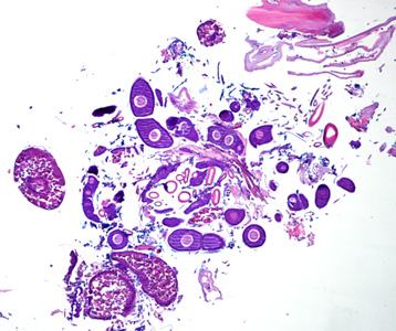 Case275_B.jpg Figure B