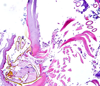 Case275_C.jpg Figure C