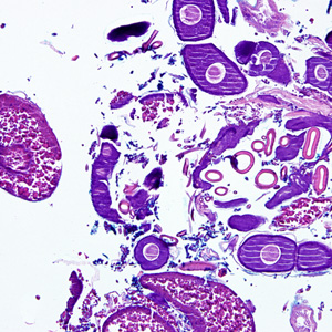 Case275_D.jpg Figure D