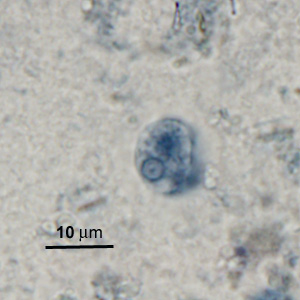 Case276_B.jpg Figure B