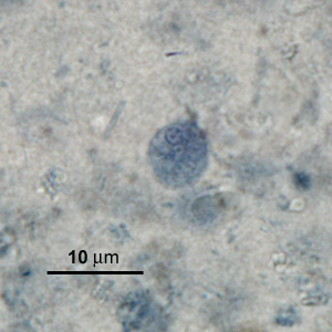 Case276_C.jpg Figure C