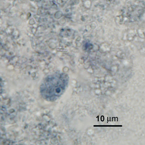 Case276_D.jpg Figure D