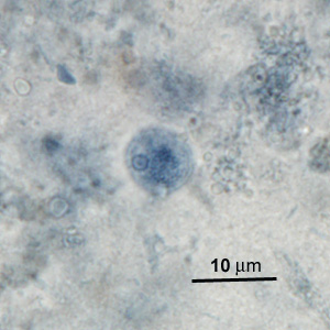 Case276_E.jpg Figure E