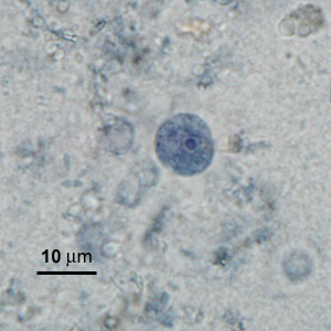 Case276_F.jpg Figure F